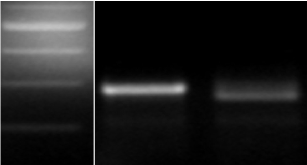 300 bp and 200 bp, M 2174 and Jagger marker for genotyping.
